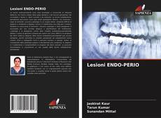 Lesioni ENDO-PERIO的封面