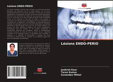 Couverture de Lésions ENDO-PERIO