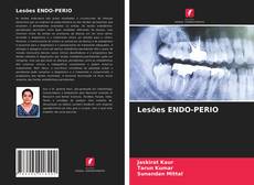 Borítókép a  Lesões ENDO-PERIO - hoz