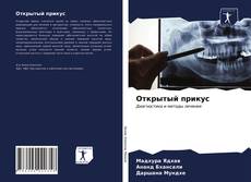 Borítókép a  Открытый прикус - hoz
