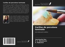 Copertina di Carillas de porcelana laminada
