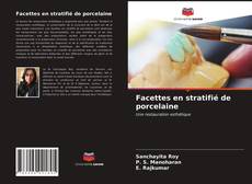 Couverture de Facettes en stratifié de porcelaine