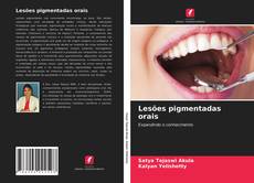Capa do livro de Lesões pigmentadas orais 