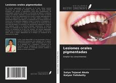 Copertina di Lesiones orales pigmentadas