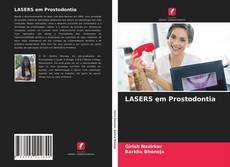 Bookcover of LASERS em Prostodontia