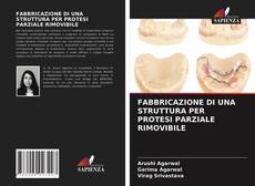 FABBRICAZIONE DI UNA STRUTTURA PER PROTESI PARZIALE RIMOVIBILE的封面