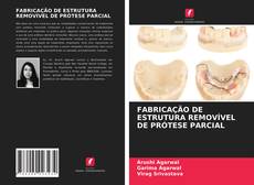 Bookcover of FABRICAÇÃO DE ESTRUTURA REMOVÍVEL DE PRÓTESE PARCIAL