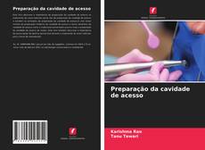 Bookcover of Preparação da cavidade de acesso