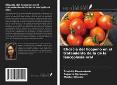 Buchcover von Eficacia del licopeno en el tratamiento de la de la leucoplasia oral