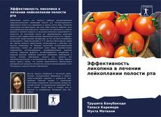 Copertina di Эффективность ликопина в лечении лейкоплакии полости рта