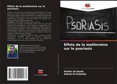 Обложка Effets de la metformine sur le psoriasis