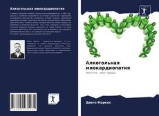 Bookcover of Алкогольная миокардиопатия