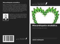 Copertina di Miocardiopatía alcohólica