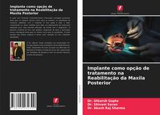 Bookcover of Implante como opção de tratamento na Reabilitação da Maxila Posterior