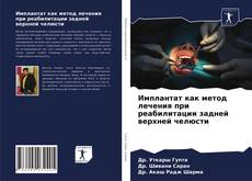 Обложка Имплантат как метод лечения при реабилитации задней верхней челюсти