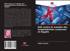 Couverture de Défi contre la maladie des lymphadénites caséeuses en Égypte