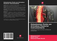 Copertina di Osteotomias Ponte em Artrodese Posterior Instrumentária