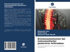 Brückenosteotomien bei instrumentierter posteriorer Arthrodese的封面