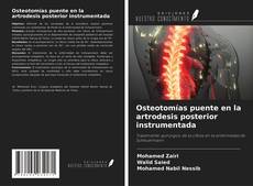 Couverture de Osteotomías puente en la artrodesis posterior instrumentada