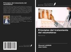 Copertina di Principios del tratamiento del neumotórax