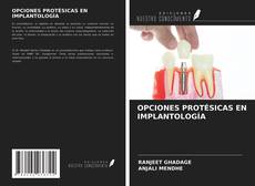 Copertina di OPCIONES PROTÉSICAS EN IMPLANTOLOGÍA
