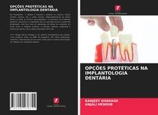 Bookcover of OPÇÕES PROTÉTICAS NA IMPLANTOLOGIA DENTÁRIA