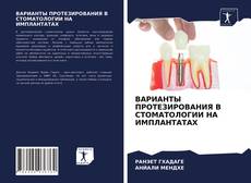 Copertina di ВАРИАНТЫ ПРОТЕЗИРОВАНИЯ В СТОМАТОЛОГИИ НА ИМПЛАНТАТАХ