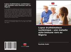 Couverture de Lupus érythémateux systémique : une maladie auto-immune rare au Nigeria