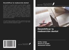 Bookcover of Desmitificar la reabsorción dental