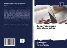 Bookcover of Демистификация резорбции зубов