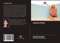 Couverture de Lamina Dura