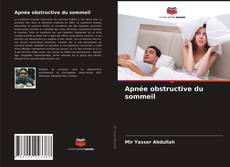 Couverture de Apnée obstructive du sommeil