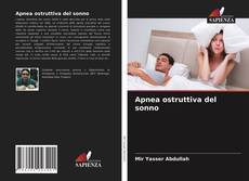 Apnea ostruttiva del sonno的封面