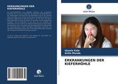 Couverture de ERKRANKUNGEN DER KIEFERHÖHLE