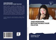 Copertina di ЗАБОЛЕВАНИЯ ВЕРХНЕЧЕЛЮСТНОЙ ПАЗУХИ