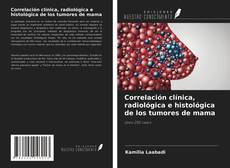 Bookcover of Correlación clínica, radiológica e histológica de los tumores de mama