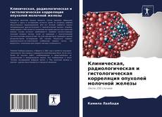 Copertina di Клиническая, радиологическая и гистологическая корреляция опухолей молочной железы