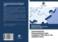 Portada del libro de Traumatische Eimerschlaufe des medialen Meniskus am stabilen Knie