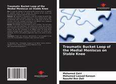 Traumatic Bucket Loop of the Medial Meniscus on Stable Knee的封面