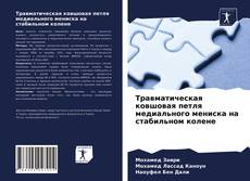 Buchcover von Травматическая ковшовая петля медиального мениска на стабильном колене