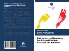 Calcaneusverlängerung bei idiopathischem Plattfuß bei Kindern的封面
