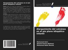 Buchcover von Alargamiento del calcáneo en el pie plano idiopático infantil