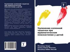 Copertina di Удлинение коленной чашечки при идиопатическом плоскостопии у детей