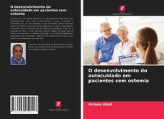 Copertina di O desenvolvimento do autocuidado em pacientes com ostomia
