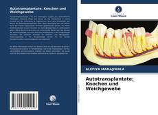 Borítókép a  Autotransplantate: Knochen und Weichgewebe - hoz