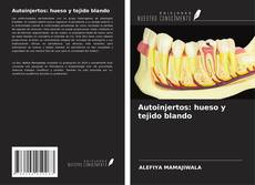 Bookcover of Autoinjertos: hueso y tejido blando