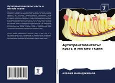 Capa do livro de Аутотрансплантаты: кость и мягкие ткани 