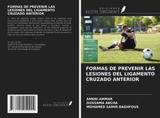 Bookcover of FORMAS DE PREVENIR LAS LESIONES DEL LIGAMENTO CRUZADO ANTERIOR