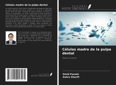 Bookcover of Células madre de la pulpa dental