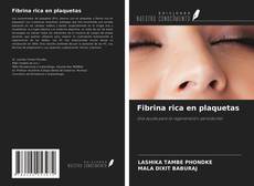 Buchcover von Fibrina rica en plaquetas